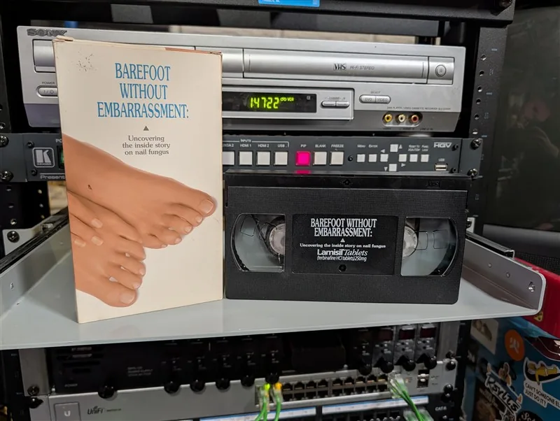 Barefoot Without Embarrassment: Uncovering the Inside Story on Nail Fungus: tape photo 1